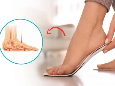 Düztabanlık (Taban Düşüklüğü) ve Tedavisi Hakkında Merak Edilenler!