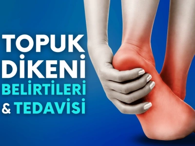Topuk Dikeni Belirtileri ve Tedavisi