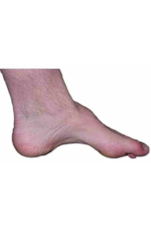 Yüksek Kavis Kişiye Özel Tabanlık (Özel Cihaz ile Analiz Yapılarak Hazırlanmaktadır)