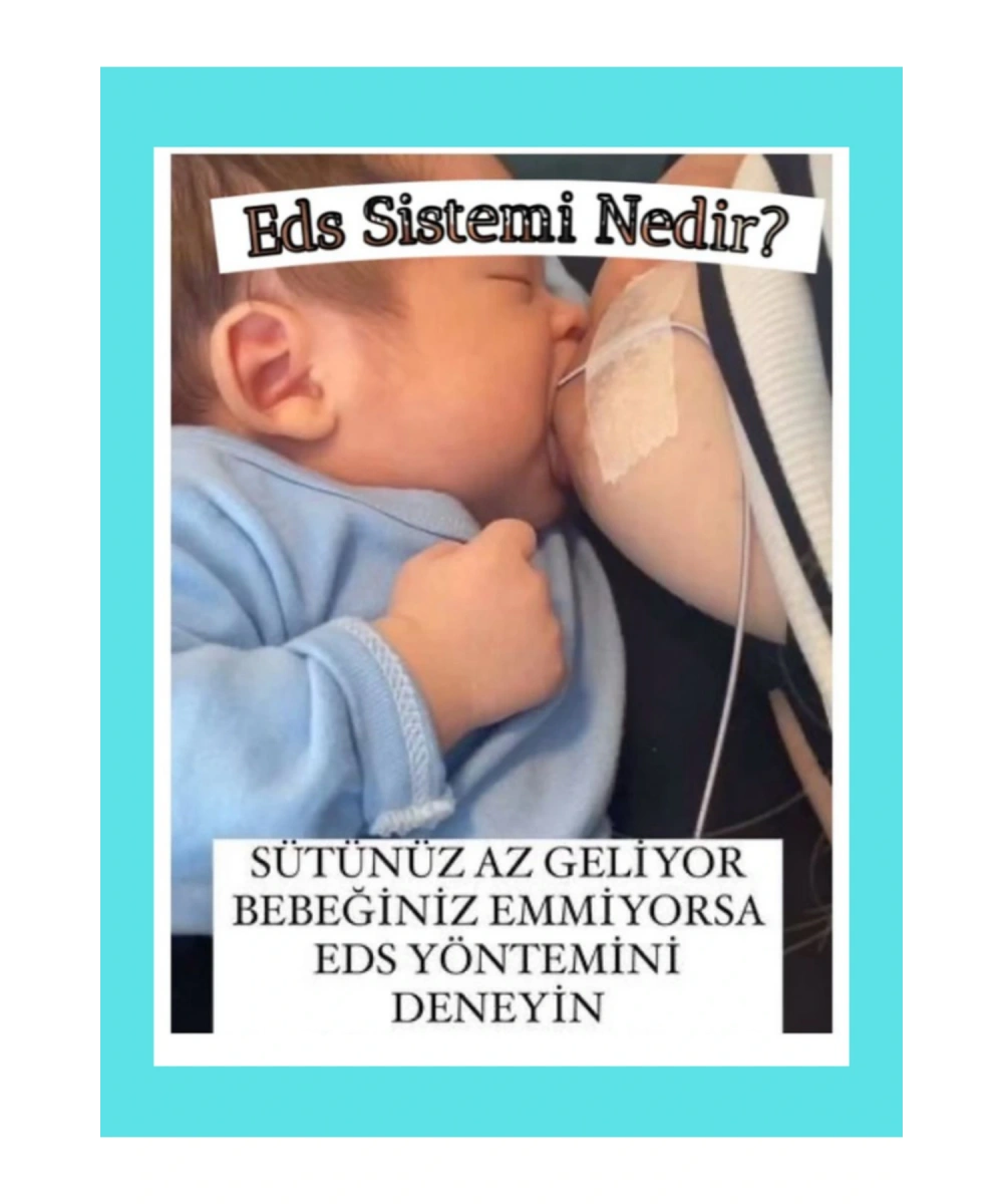 Emzirme Destek Sistemi No:10 Beslenme Sondası Siyah Eds Sabitleme Bant Ve Kilitli Enjektör Hediyeli