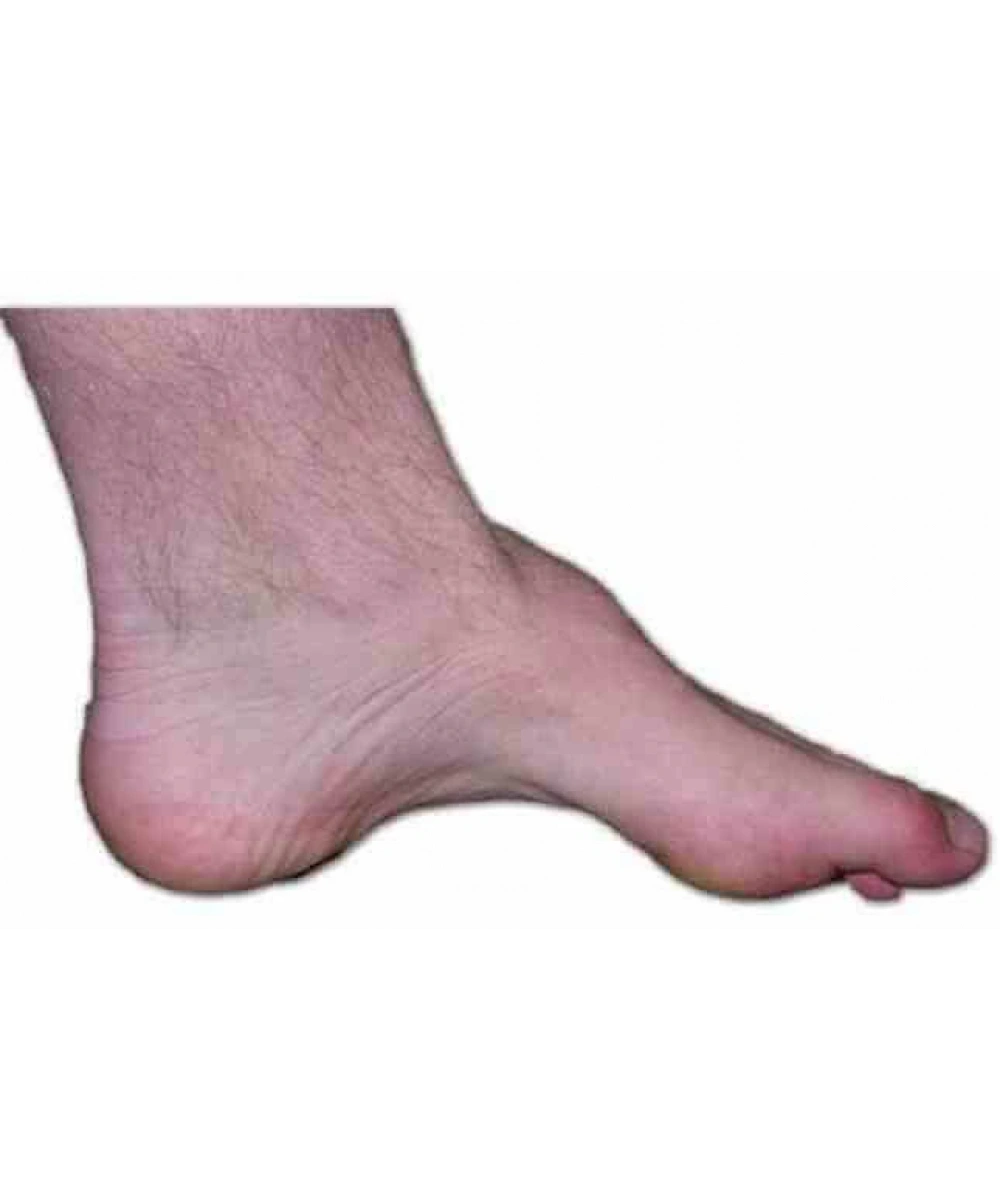 Yüksek Kavis Kişiye Özel Tabanlık (Özel Cihaz ile Analiz Yapılarak Hazırlanmaktadır)