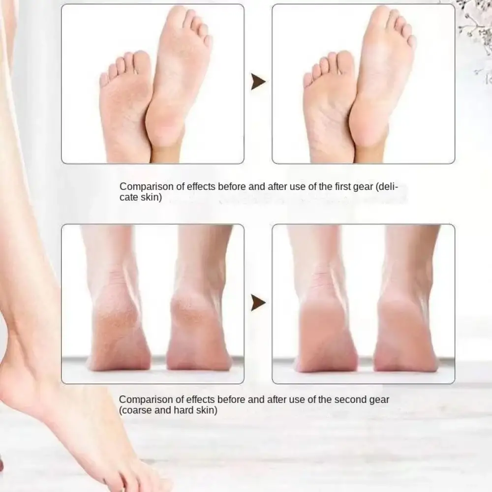 Şarjlı Ayak Törpüsü