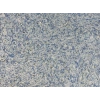 DRS - 1 No: 21