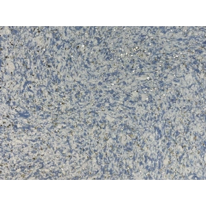 DRS - 1 No: 21
