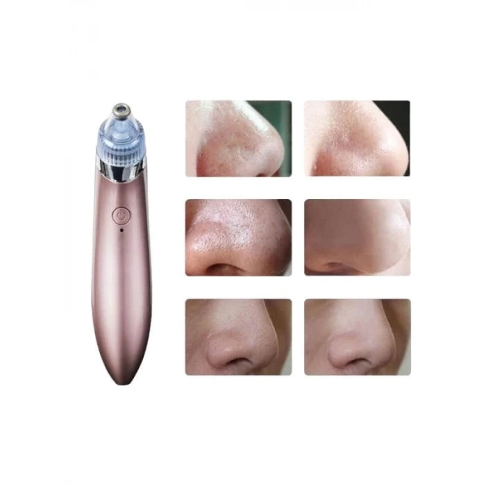 CEYLAN ADAM SİYAH NOKTA CİHAZI