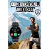 CEYLAN ADAM Akıllı Saat Çok Fonksiyonlu Sesli Görüşme NFC Uyumlu Amoled Ekran