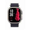 Mey İthalat® Ultra Akıllı Saat 49 Mm Çift Kordonlu Arama Cevaplama Bluetooth Bağlantılı