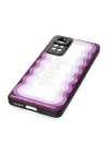 Xiaomi Redmi Note 11 Pro Kılıf Mirror Desenli Kapak - Mirror - 5