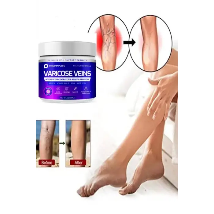 Maximum Strength Varicose Vein Var.is Bacak Bakım Masaj Kremi 100 ml 2 Adet