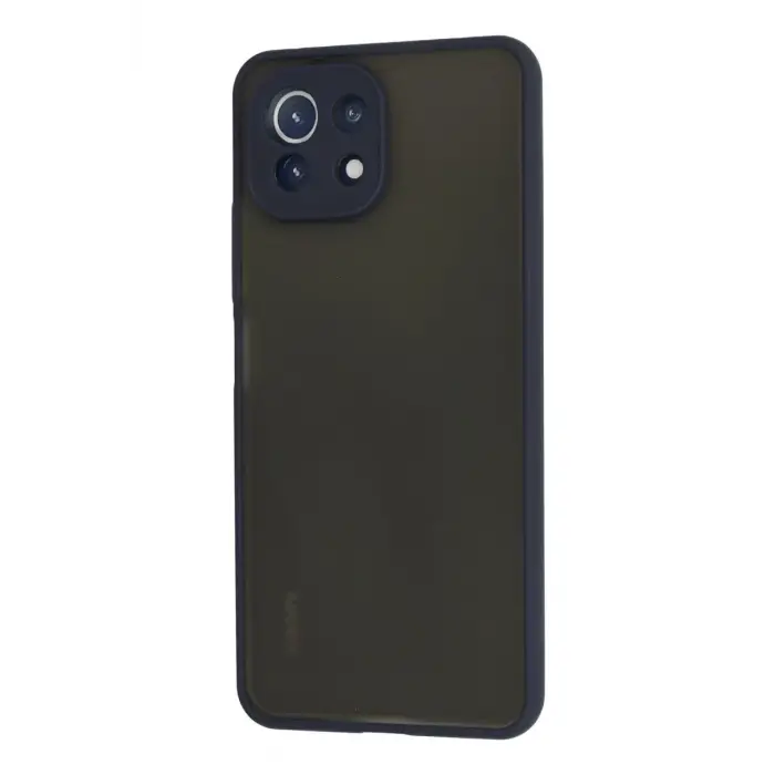 Newface Xiaomi Mİ 11 Lite Kılıf Montreal Silikon Kapak - Lacivert
