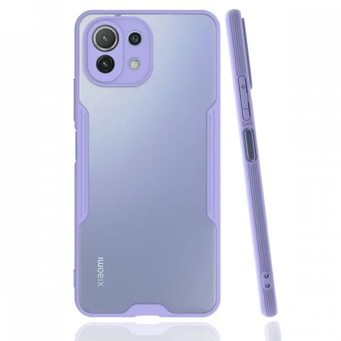 Newface Xiaomi Mİ 11 Lite Kılıf Platin Silikon - Lila