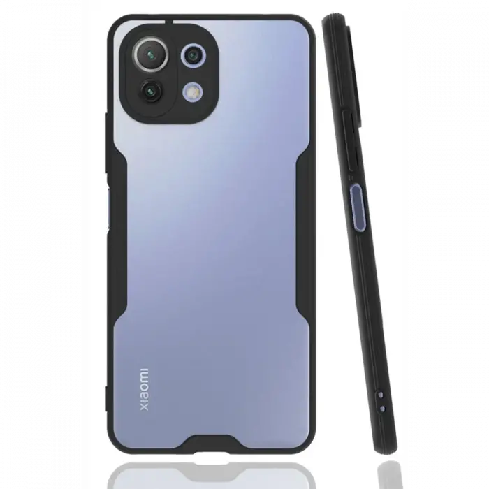 Newface Xiaomi Mİ 11 Lite Kılıf Platin Silikon - Siyah