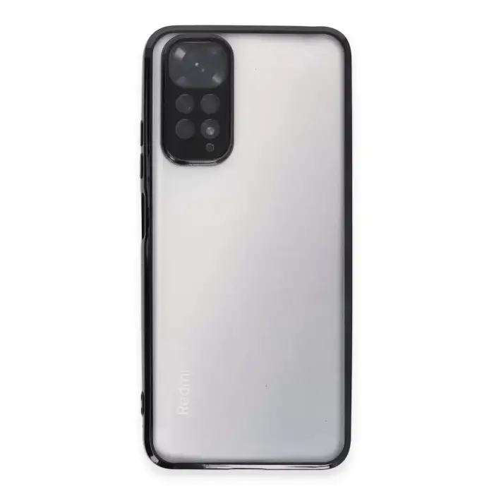 Newface Xiaomi Redmi Note 11 Kılıf Razer Lensli Silikon - Siyah