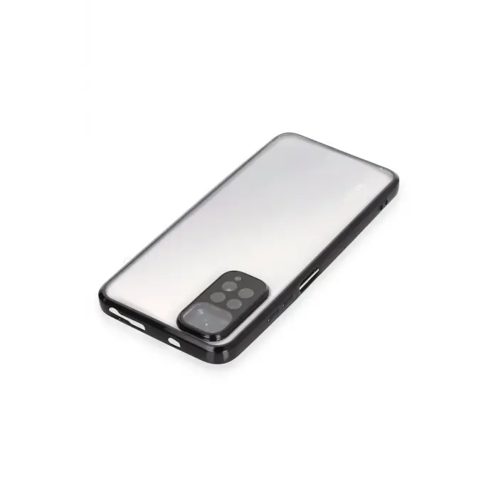 Newface Xiaomi Redmi Note 11 Kılıf Razer Lensli Silikon - Siyah