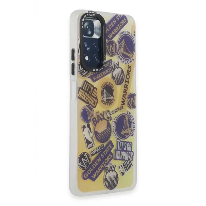Newface Xiaomi Redmi Note 11 Pro Kılıf Estoril Desenli Kapak - Estoril - 13