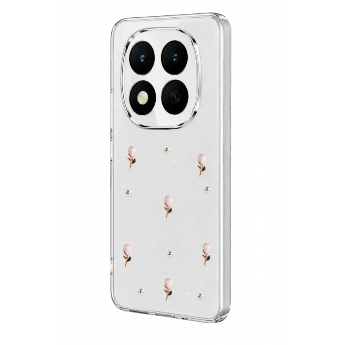 Newface Xiaomi Redmi Note 15 Pro 4G Fiyonk Desenli Kapak - Desen 6