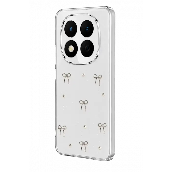 Newface Xiaomi Redmi Note 15 Pro Plus 5G Fiyonk Desenli Kapak - Desen 5