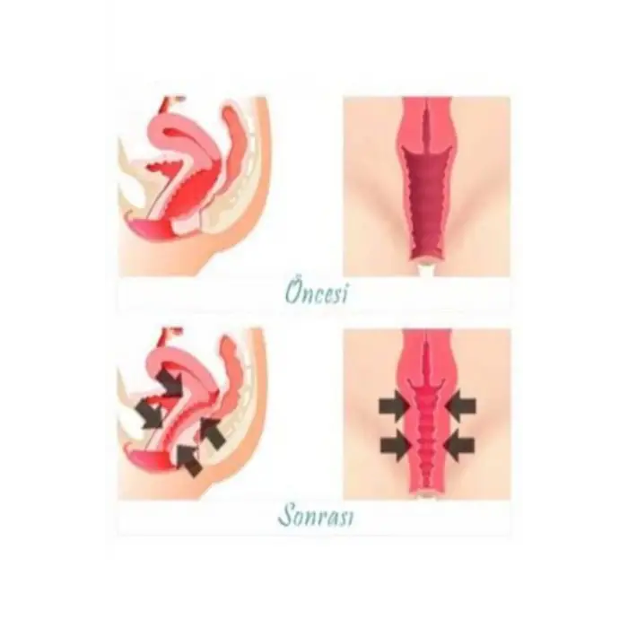 Vagitight Kadınlara Özel Genital Bölge Şekillendirici Krem 100 ml X 3 ADET