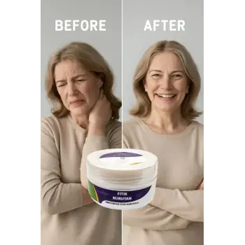 FITIK KURUTAN KREM 50 ML