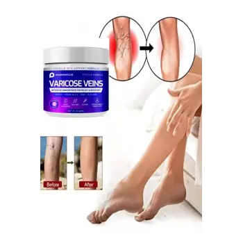 Maximum Strength Varicose Vein Var.is Bacak Bakım Masaj Kremi 100 ml 2 Adet
