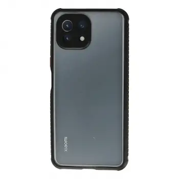 Mİ 11 Lite Kılıf Miami Şeffaf Silikon - Siyah