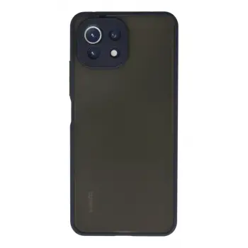Newface Xiaomi Mİ 11 Lite Kılıf Montreal Silikon Kapak - Lacivert