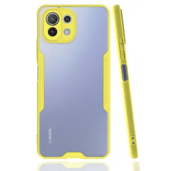 Newface Xiaomi Mİ 11 Lite Kılıf Platin Silikon - Sarı