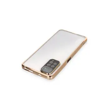 Newface Xiaomi Redmi Note 11 Kılıf Razer Lensli Silikon - Gold