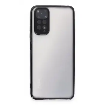 Newface Xiaomi Redmi Note 11 Kılıf Razer Lensli Silikon - Siyah