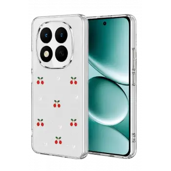 Newface Xiaomi Redmi Note 15 Pro Plus 5G Fiyonk Desenli Kapak - Desen 9