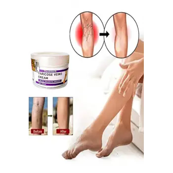 Varix Varicose Veins Purple Bakım Kremi 100 ml