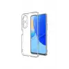 Newface Huawei Nova 9 SE Kılıf Lüx Şeffaf Silikon