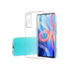 Newface Xiaomi Mi 12 Kılıf Lüx Şeffaf Silikon