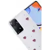 Newface Xiaomi Redmi Note 11 Pro Fiyonk Desenli Kapak - Desen 3