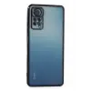 Newface Xiaomi Redmi Note 11 Pro Kılıf Razer Lensli Silikon - Siyah