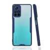 Newface Xiaomi Redmi Note 11T Kılıf Platin Silikon - Lacivert