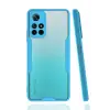 Newface Xiaomi Redmi Note 11T Kılıf Platin Silikon - Mavi