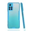 Newface Xiaomi Redmi Note 11T Kılıf Platin Silikon - Mavi