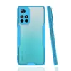 Newface Xiaomi Redmi Note 11T Kılıf Platin Silikon - Mavi