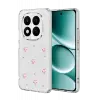 Newface Xiaomi Redmi Note 15 4G Fiyonk Desenli Kapak - Desen 3