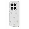 Newface Xiaomi Redmi Note 15 4G Fiyonk Desenli Kapak - Desen 5