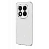 Newface Xiaomi Redmi Note 15 Pro Plus 5G Fiyonk Desenli Kapak - Desen 10