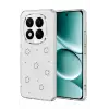 Newface Xiaomi Redmi Note 15 Pro Plus 5G Fiyonk Desenli Kapak - Desen 2