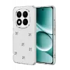 Newface Xiaomi Redmi Note 15 Pro Plus 5G Fiyonk Desenli Kapak - Desen 8
