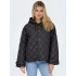 Only 15366264 Kadin Mont - Siyah