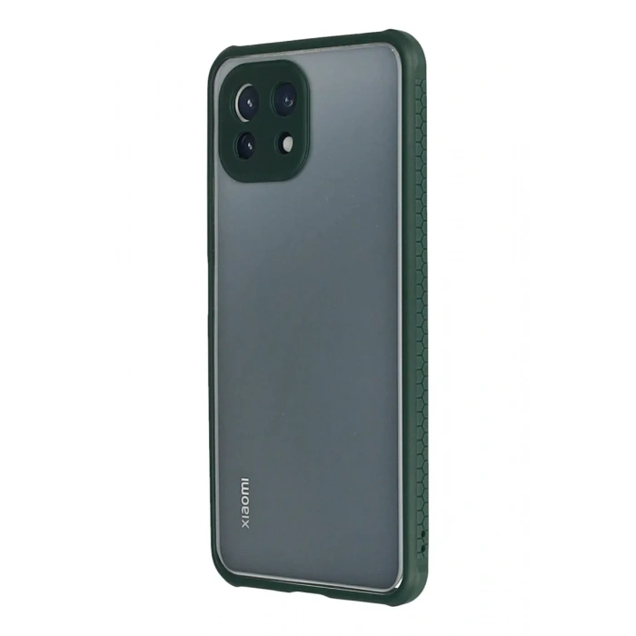 Newface Xiaomi Mİ 11 Lite Kılıf Miami Şeffaf Silikon - Koyu Yeşil