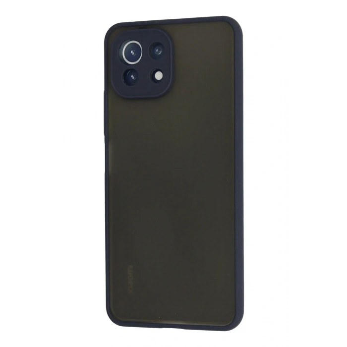 Newface Xiaomi Mİ 11 Lite Kılıf Montreal Silikon Kapak - Lacivert