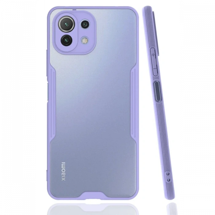 Newface Xiaomi Mİ 11 Lite Kılıf Platin Silikon - Lila