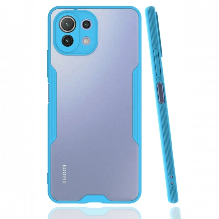 Newface Xiaomi Mİ 11 Lite Kılıf Platin Silikon - Mavi