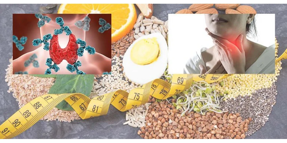 Haşimato Hastalığında Beslenme Nasıl Olmalı?